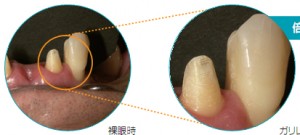 拡大鏡使用のイメージ